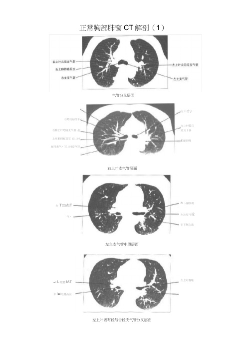 正常胸部CT解剖(肺窗和纵隔窗)