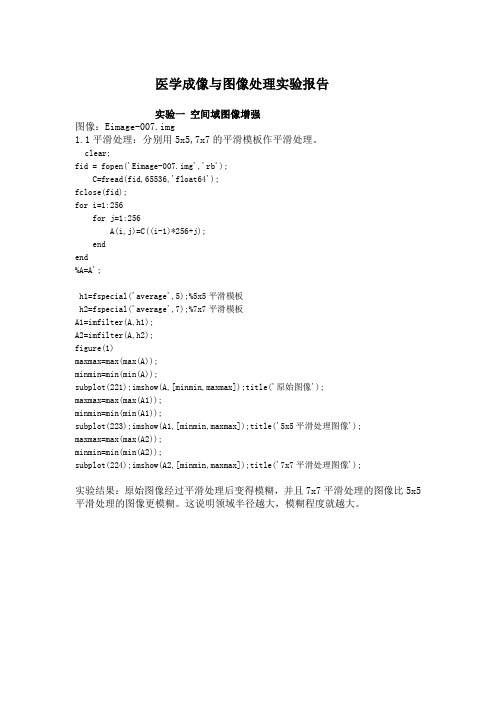 医学成像与图像处理实验报告