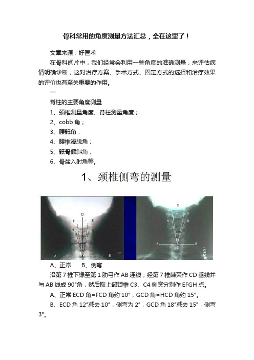 骨科常用的角度测量方法汇总，全在这里了！