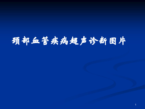 (医学课件)全系颈动脉疾病B超诊断图解