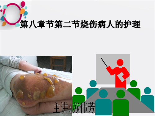 医学ppt--第8章第二节烧伤ppt课件