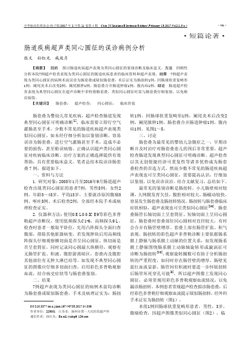 肠道疾病超声类同心圆征的误诊病例分析