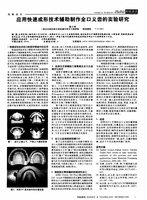 应用快速成形技术辅助制作全口义齿的实验研究