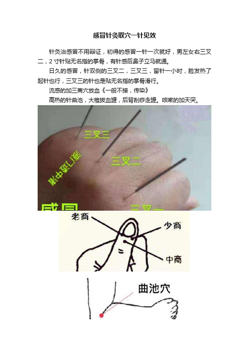 感冒针灸取穴一针见效