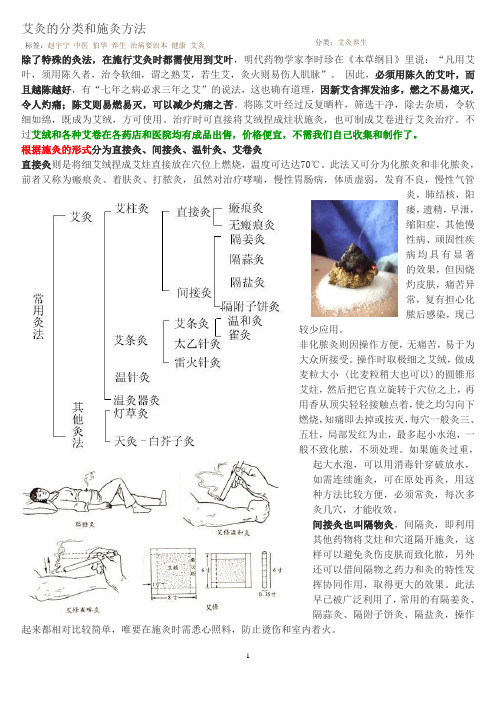 艾灸的分类和施灸方法