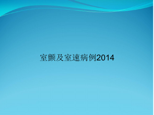 室颤及室速病例2014