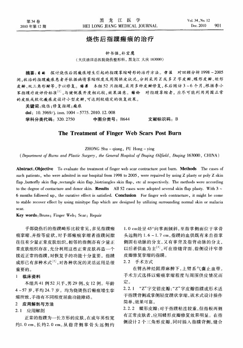 烧伤后指蹼瘢痕的治疗