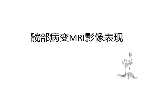 髋部病变MRI影像表现