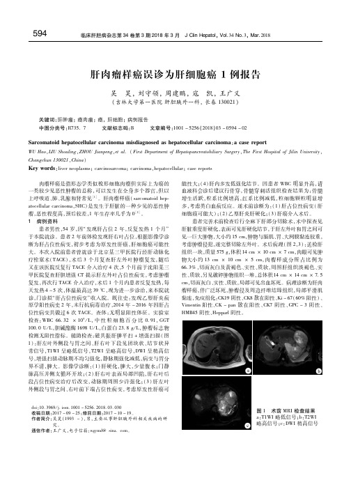 肝肉瘤样癌误诊为肝细胞癌1例报告 吴 昊