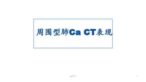 周围型肺Ca_CT表现  ppt课件