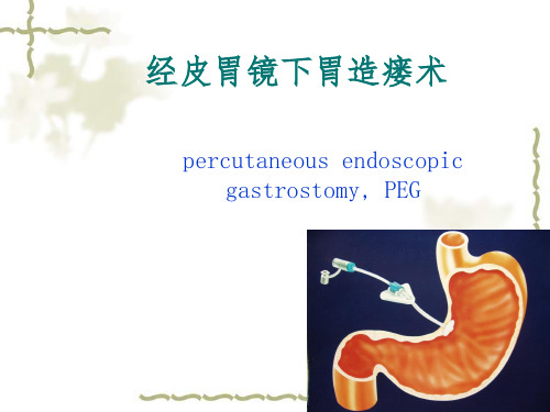 经皮胃镜下胃造瘘