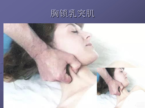 胸锁乳突肌解剖与痛点分析