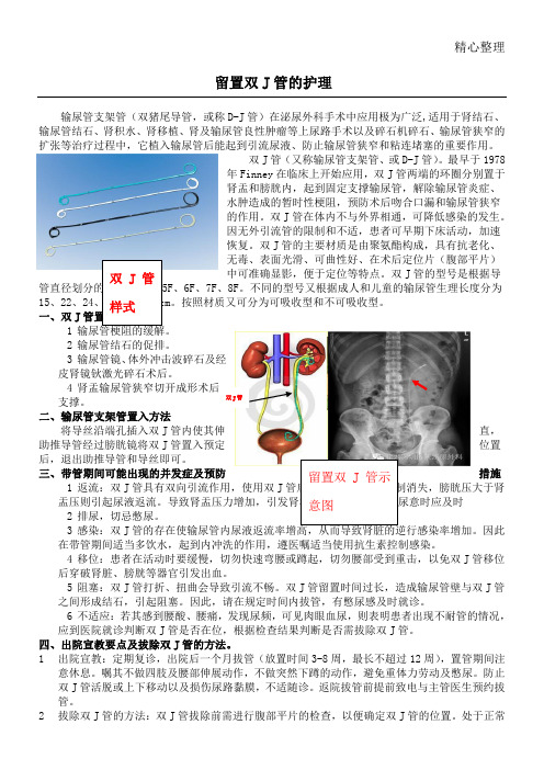 输尿管支架护理