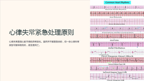 心律失常紧急处理原则