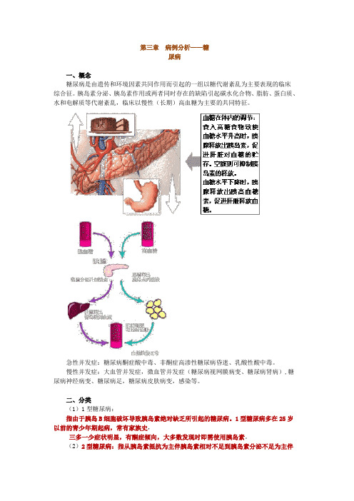 病例分析——糖尿病