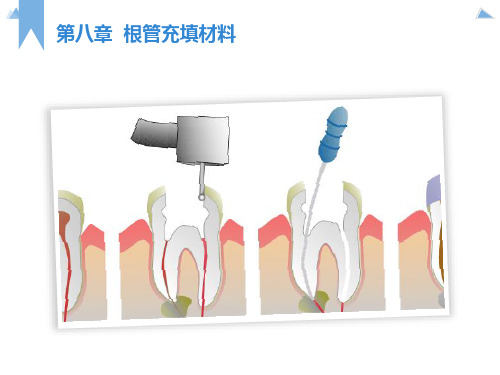 根管充填材料