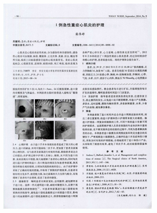 1例急性重症心肌炎的护理