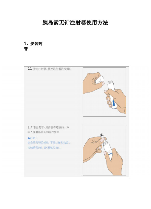 胰岛素无针注射器使用方法