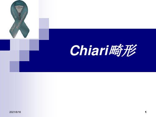 小脑扁桃体下疝(Chiari畸形)