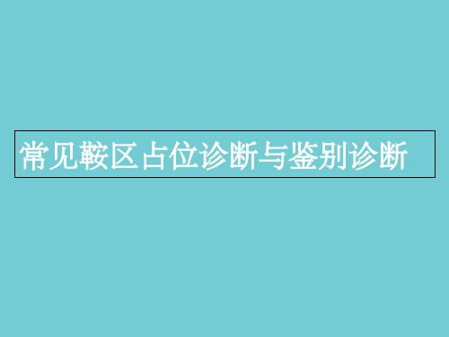 鞍区占位(1)