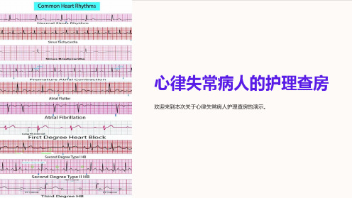 心律失常病人的护理查房