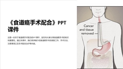 《食道癌手术配合》课件