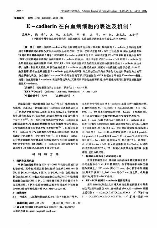 E—cadherin在白血病细胞的表达及机制