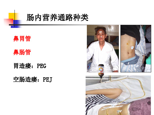 留置胃管幻灯片课件.ppt