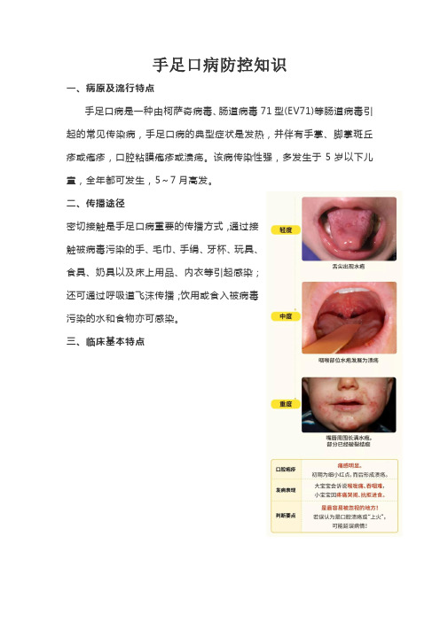 手足口病宣传单