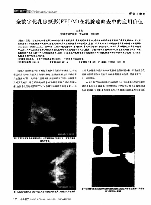 全数字化乳腺摄影(FFDM)在乳腺癌筛查中的应用价值