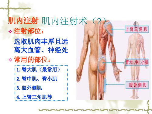 肌内注射常用注射部位