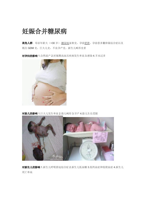 妊娠合并糖尿病健康宣教