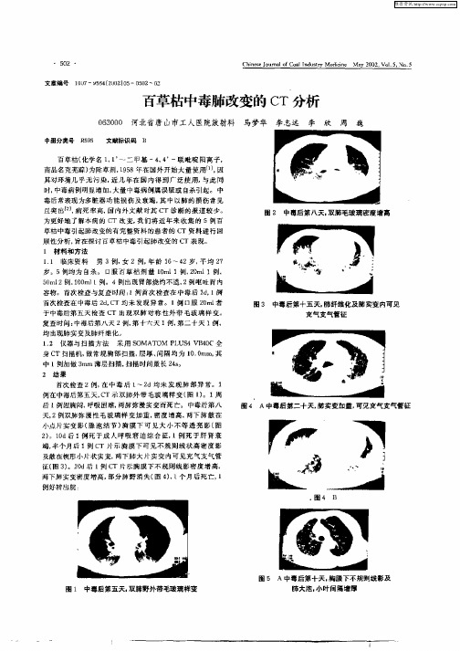 百草枯中毒肺改变的CT分析