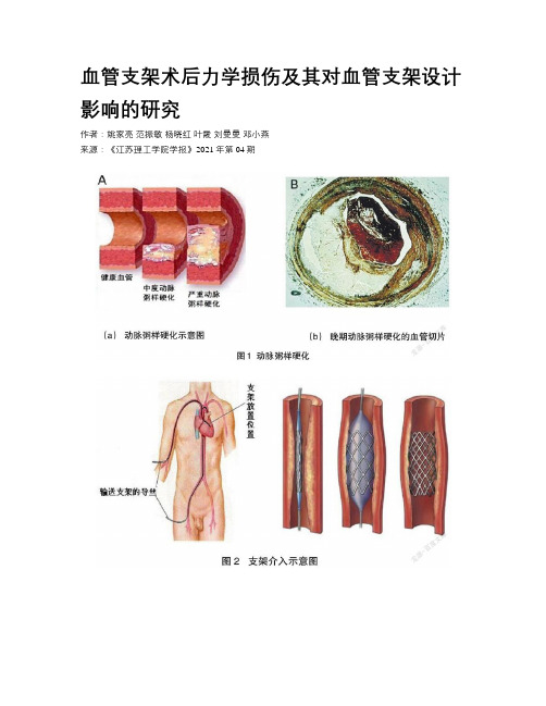 血管支架术后力学损伤及其对血管支架设计影响的研究