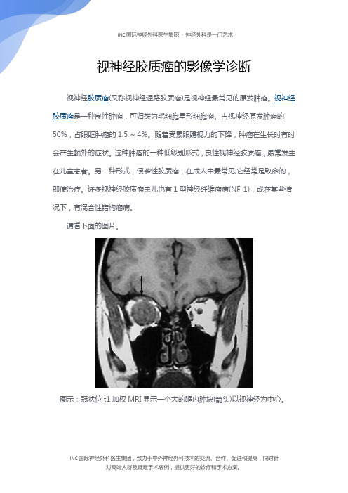 视神经胶质瘤的影像学诊断