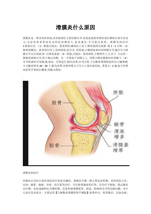 滑膜炎什么原因