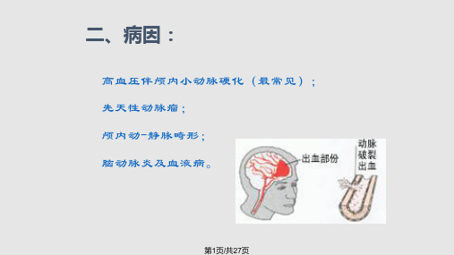 脑出血业务学习PPT1PPT课件