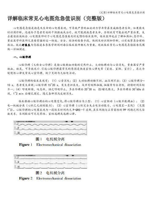 (完整)详解临床常见心电图危急值识别