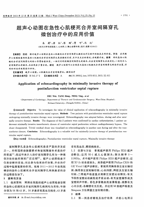 超声心动图在急性心肌梗死合并室间隔穿孔微创治疗中的应用价值