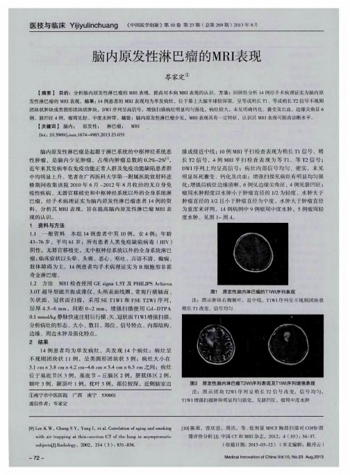 脑内原发性淋巴瘤的MRI表现