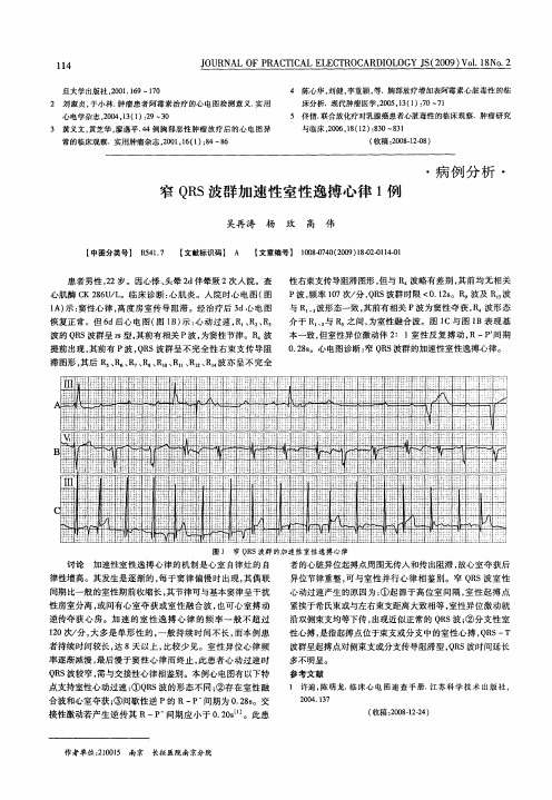 窄QRS波群加速性室性逸搏心律1例