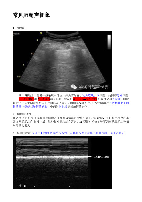 肺部超声--一些常见形象征象的解释