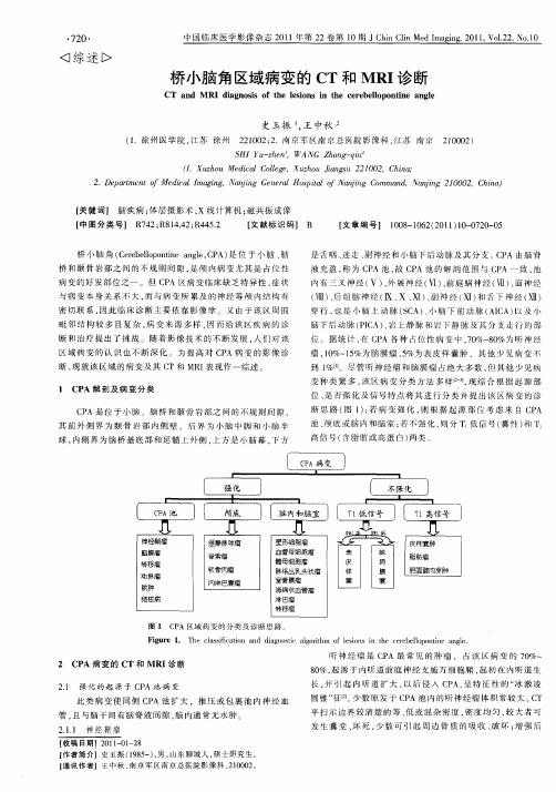 桥小脑角区域病变的CT和MRI诊断