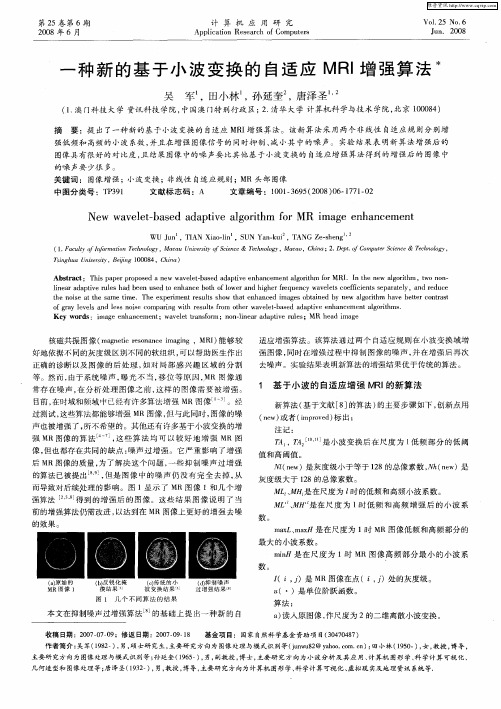 一种新的基于小波变换的自适应MRI增强算法