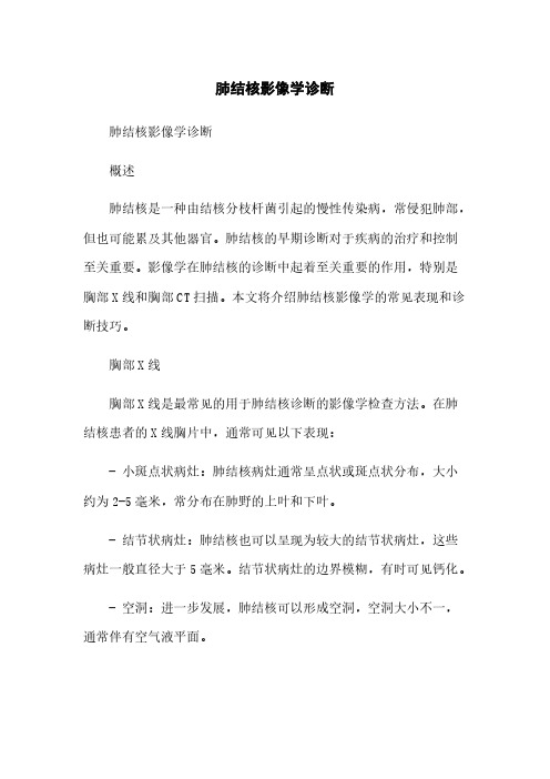 肺结核影像学诊断