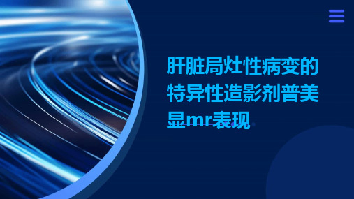 肝脏局灶性病变的特异性造影剂普美显MR表现