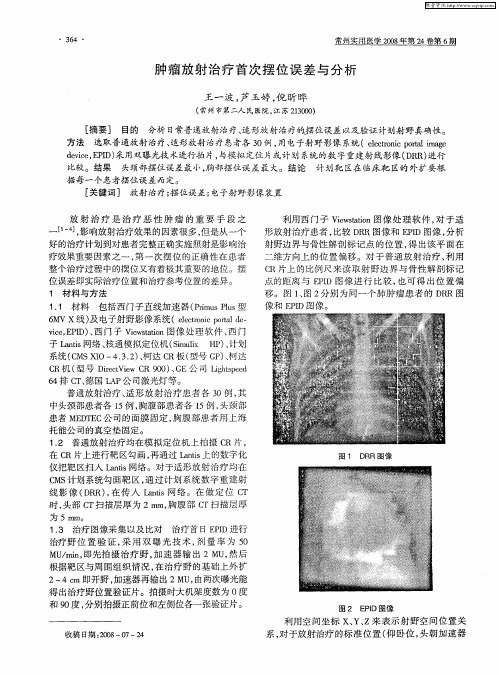 肿瘤放射治疗首次摆位误差与分析