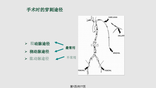 AngioSeal血管封合器PPT课件