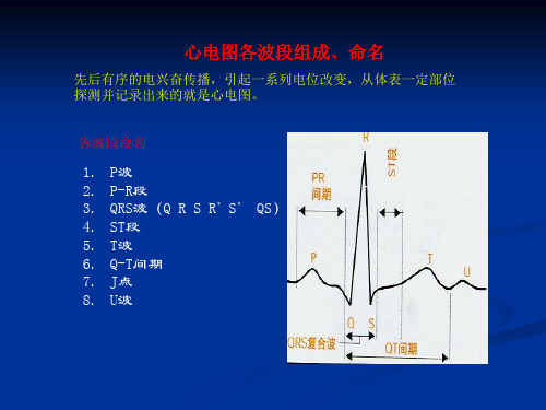 各种心电图表现