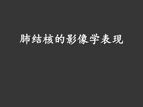 肺结核影像学表现 PPT